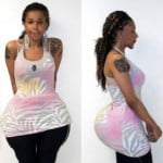 fix-a-flat-butt-plastic-surgery-300x270